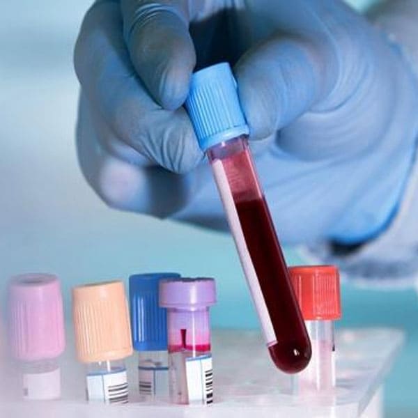 valoracion de la funcion renal