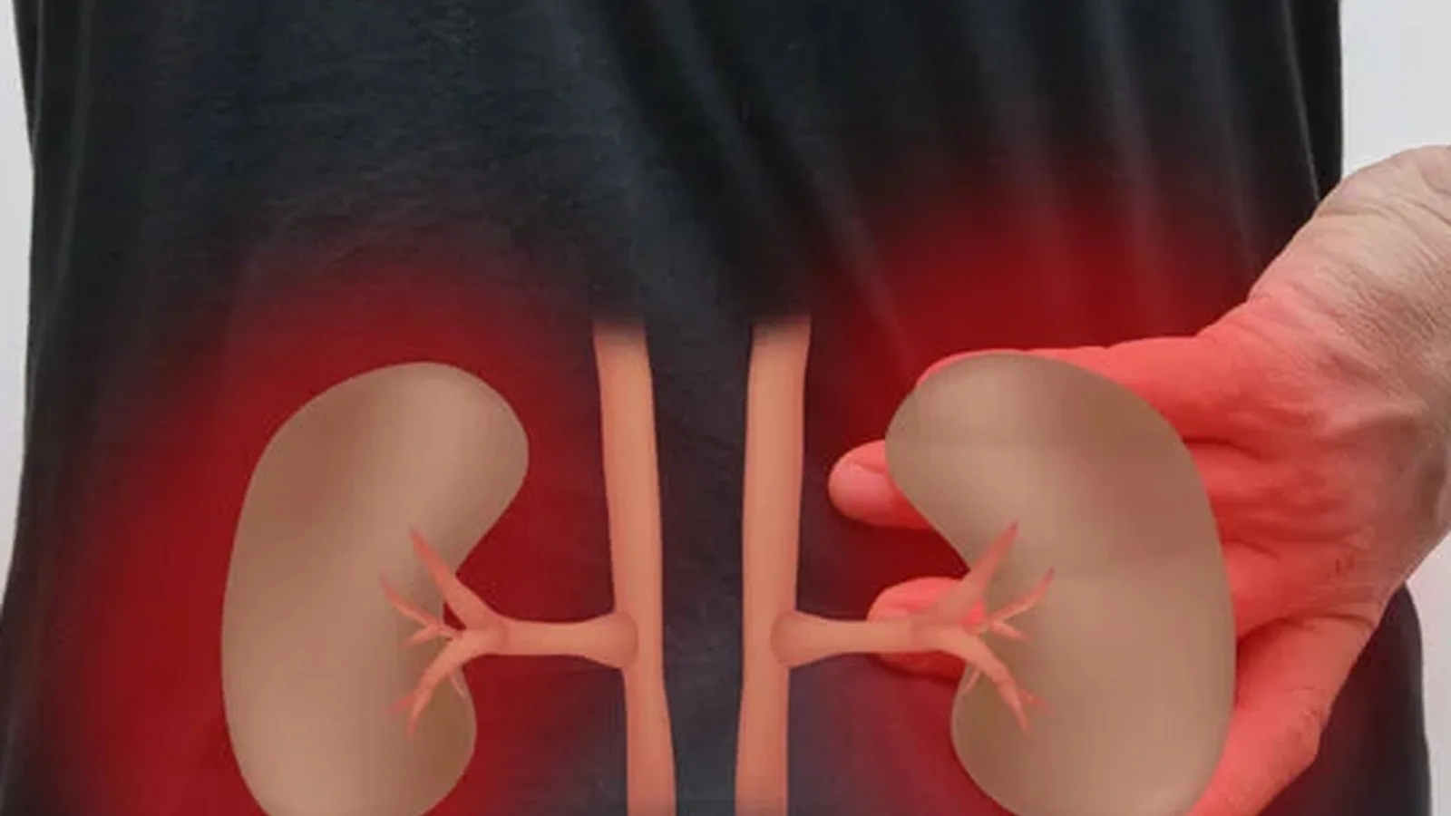 Abordaje Especializado de la Enfermedad Renal Crónica en CDMX