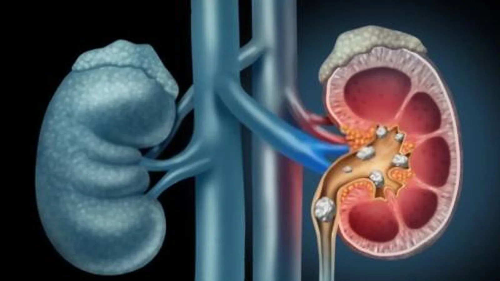 Especialista en el Manejo Integral de la Glomerulonefritis en CDMX