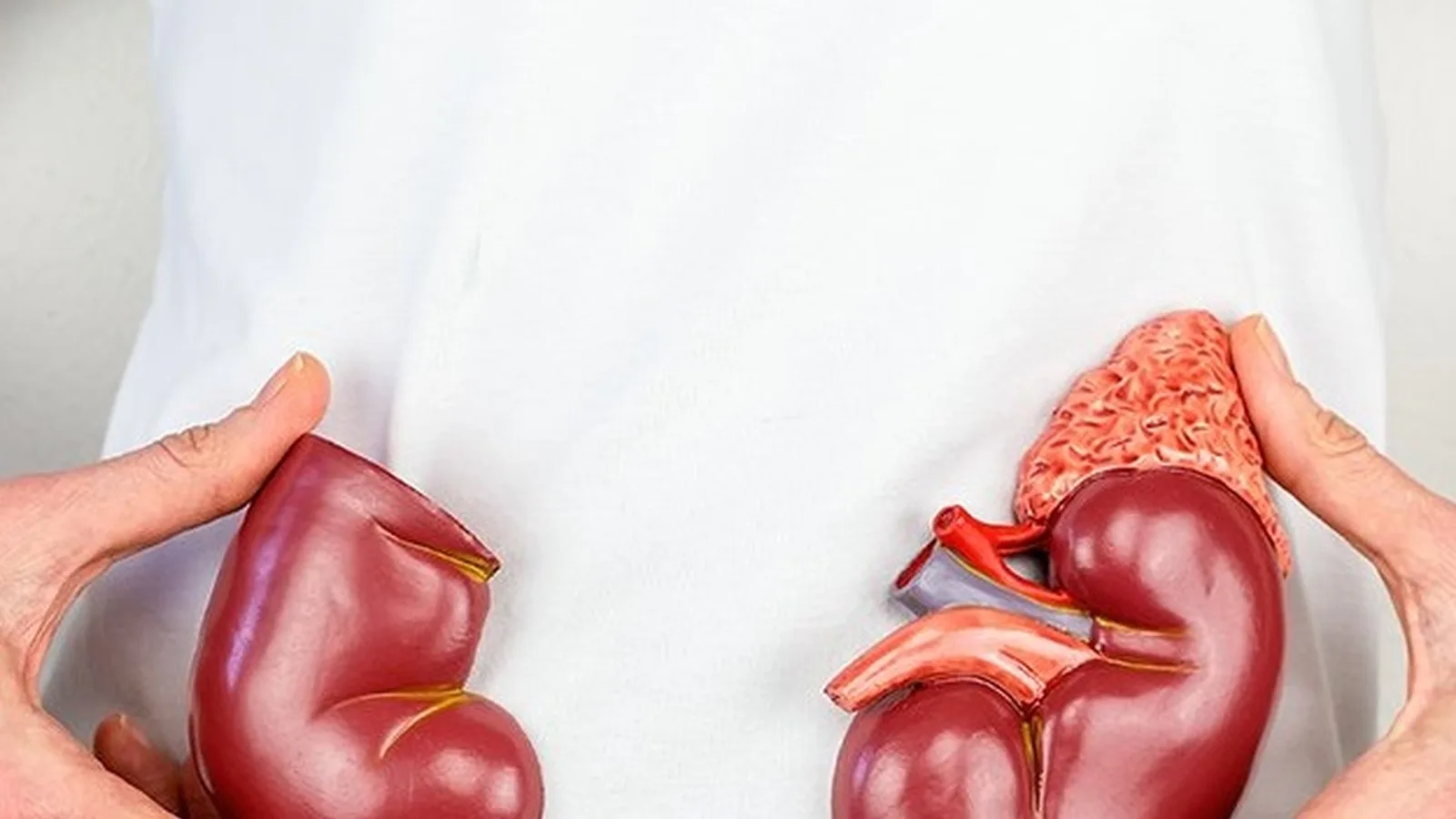 Abordaje integral de la hiponatremia en CDMX